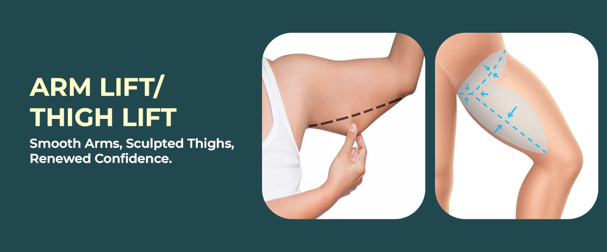Arm lift Thigh lift  treatment in Hyderabad