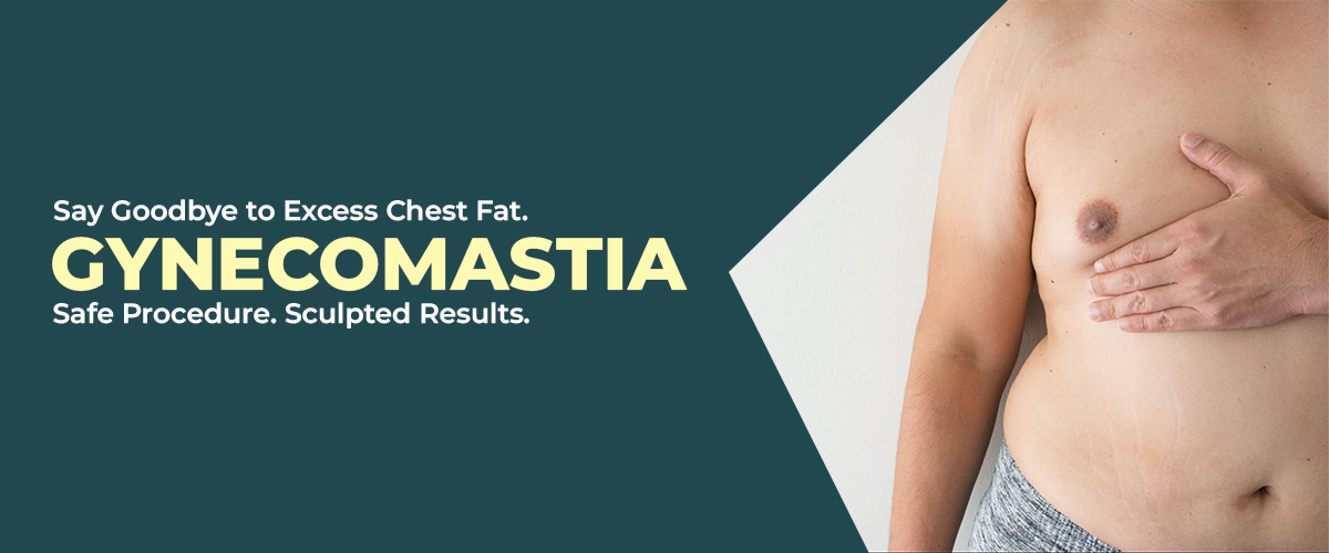 Gynecomastia treatment in Hyderabad