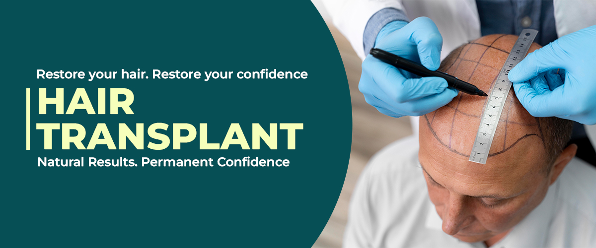 Hair Transplant Treatment In Kothapet | Hyderabad