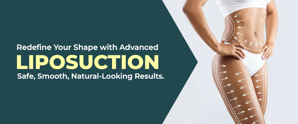 Liposuction treatment in Hyderabad