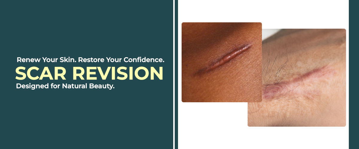 Scar Revison treatment in Hyderabad
